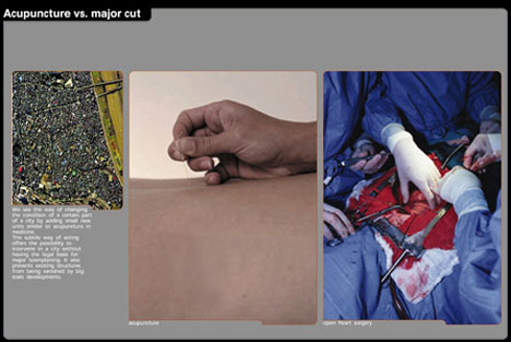 acupuncture vs. major cut